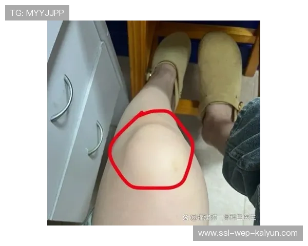 跑步膝盖疼怎么办？可能是跑姿问题，跑步膝盖疼的厉害怎么办